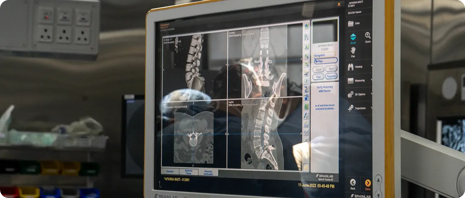 failed back surgery syndrome