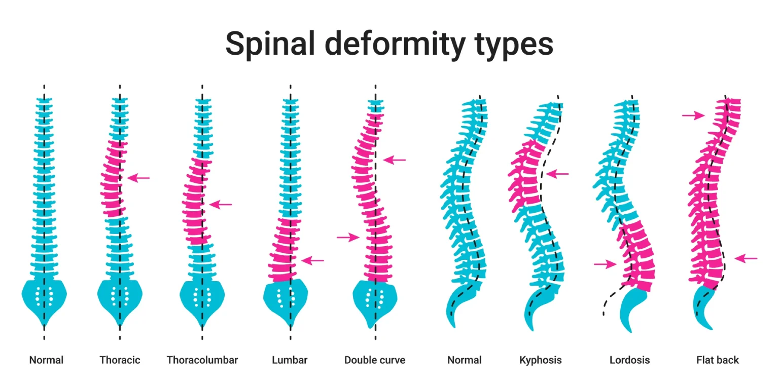 types of spine surgery