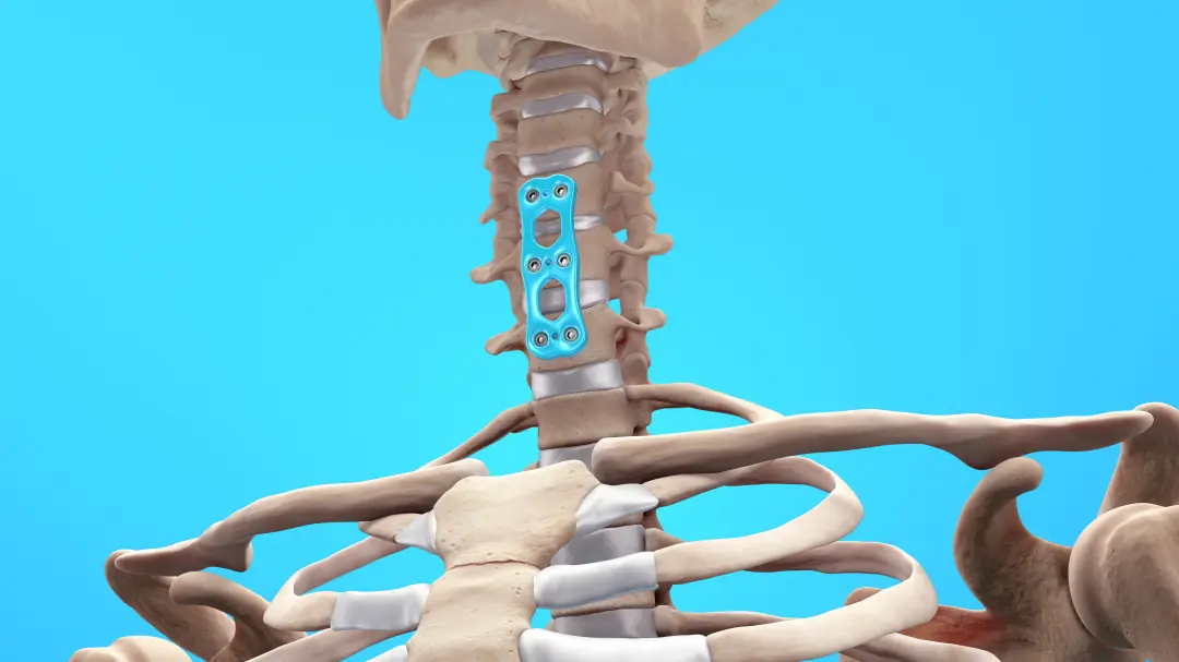 spine treatment