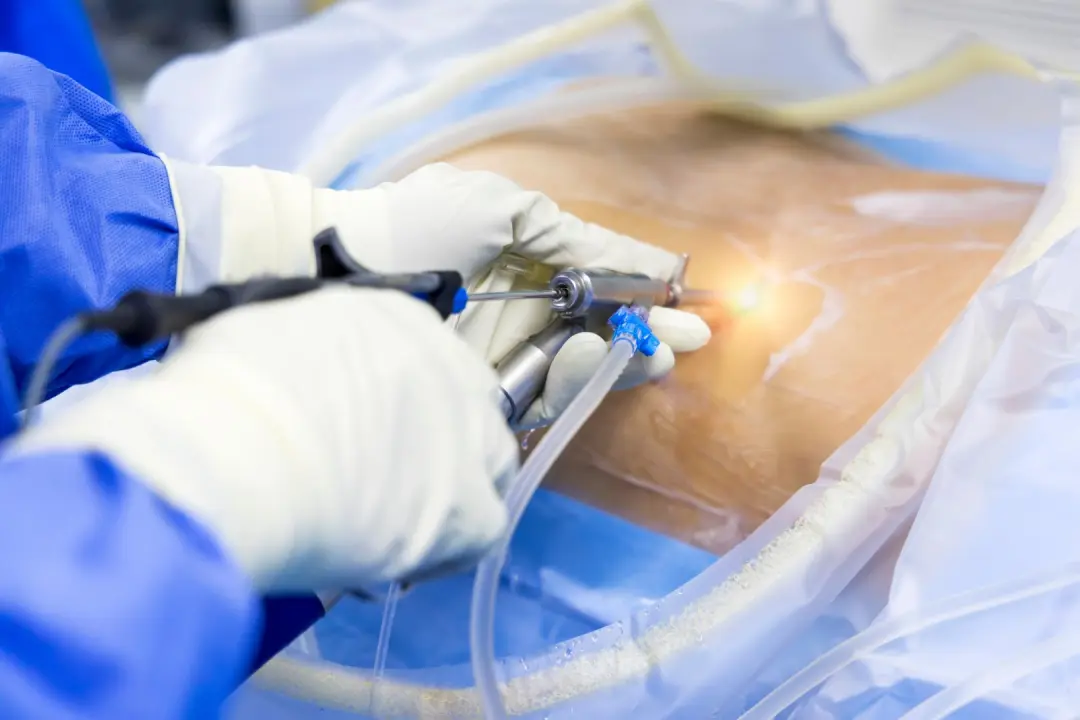 minimally invasive spine surgery