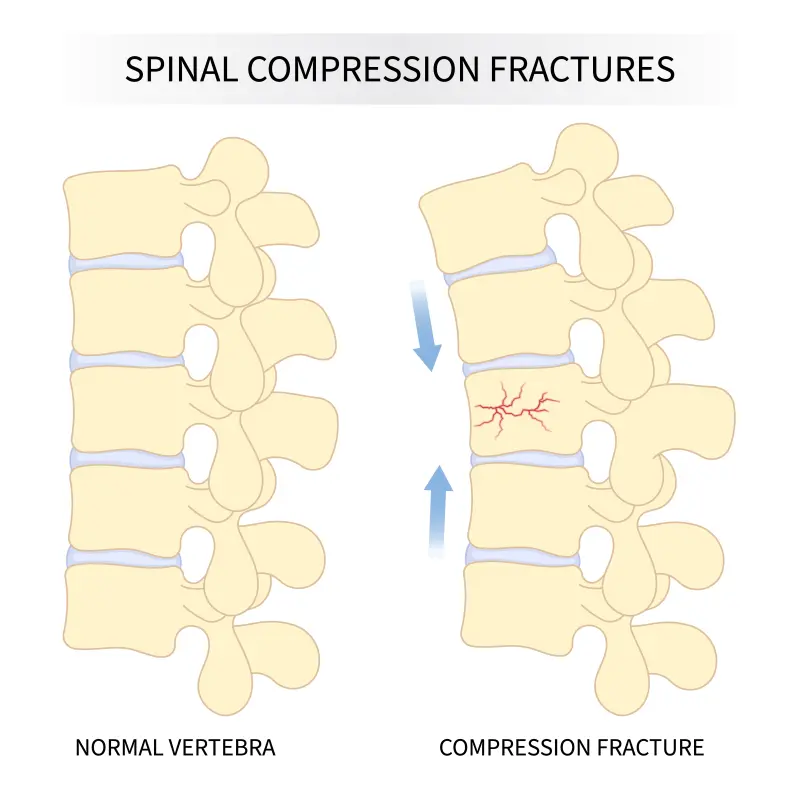 back pain treatment in bangalore